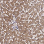 Immunohistochemical staining of human liver shows strong cytoplasmic positivity in hepatocytes.