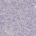 Anti-UROC1 Antibody