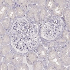 Immunohistochemical staining of human kidney shows no positivity in cells in glomeruli as expected.