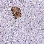 Immunohistochemical staining of human pancreas shows moderate to strong cytoplasmic positivity in islets of Langerhans.