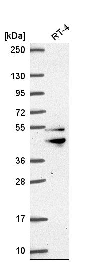 Anti-ZFYVE27 Antibody