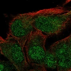 Immunofluorescent staining of human cell line SK-MEL-30 shows localization to nucleoplasm & cytosol.