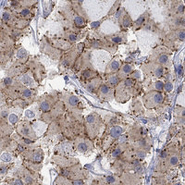 Anti-CNR1 Antibody