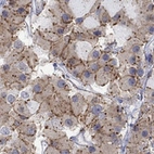 Anti-CNR1 Antibody
