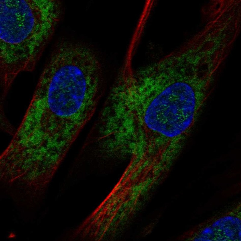 Anti-OMD Antibody
