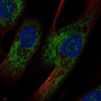 Anti-OMD Antibody