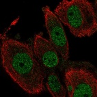 Anti-TEAD2 Antibody