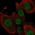 Anti-TEAD2 Antibody