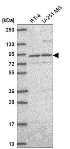 Western blot analysis in human cell line RT-4 and human cell line U-251 MG.