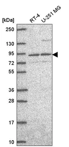 Western blot analysis in human cell line RT-4 and human cell line U-251 MG.