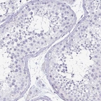 Immunohistochemical staining of human testis shows no positivity in cells in seminiferous ducts as expected.