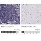 Anti-RGS19 Antibody