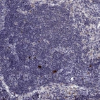 Immunohistochemical staining of human lymph node shows high expression.