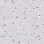 Immunohistochemical staining of human cerebral cortex shows low expression as expected.