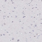 Anti-RGS19 Antibody