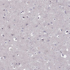 Immunohistochemical staining of human cerebral cortex shows no positivity in neuronal cells as expected.