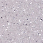 Immunohistochemical staining of human cerebral cortex shows no positivity in neuronal cells as expected.