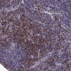Immunohistochemical staining of human tonsil shows moderate membranous positivity in lymphocytes.
