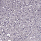 Anti-CD28 Antibody