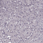 Immunohistochemical staining of human liver shows no positivity in hepatocytes.