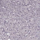 Immunohistochemical staining of human liver shows no positivity in hepatocytes.