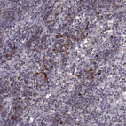 Immunohistochemical staining of human lymph node shows moderate membranous positivity in lymphocytes.