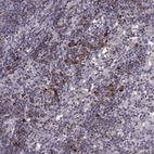 Immunohistochemical staining of human lymph node shows moderate membranous positivity in lymphocytes.