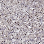 Anti-NR4A1 Antibody