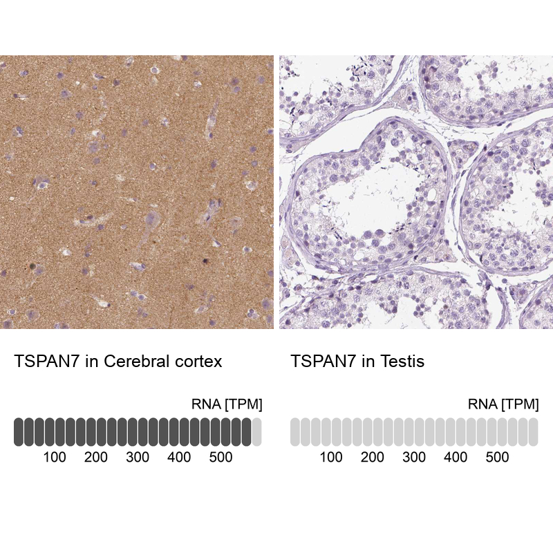Anti-TSPAN7 Antibody