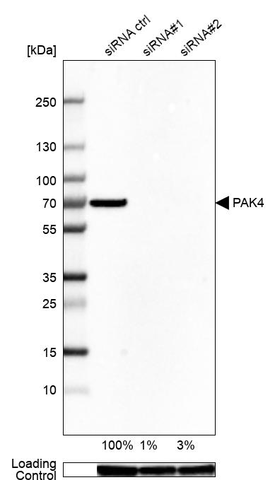 Anti-PAK4 Antibody