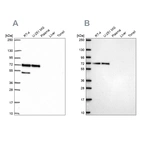 Western blot analysis using Anti-PAK4 antibody HPA070175 (A) shows similar pattern to independent antibody HPA072220 (B).