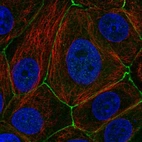 Immunofluorescent staining of human cell line MCF7 shows localization to plasma membrane & cell junctions.