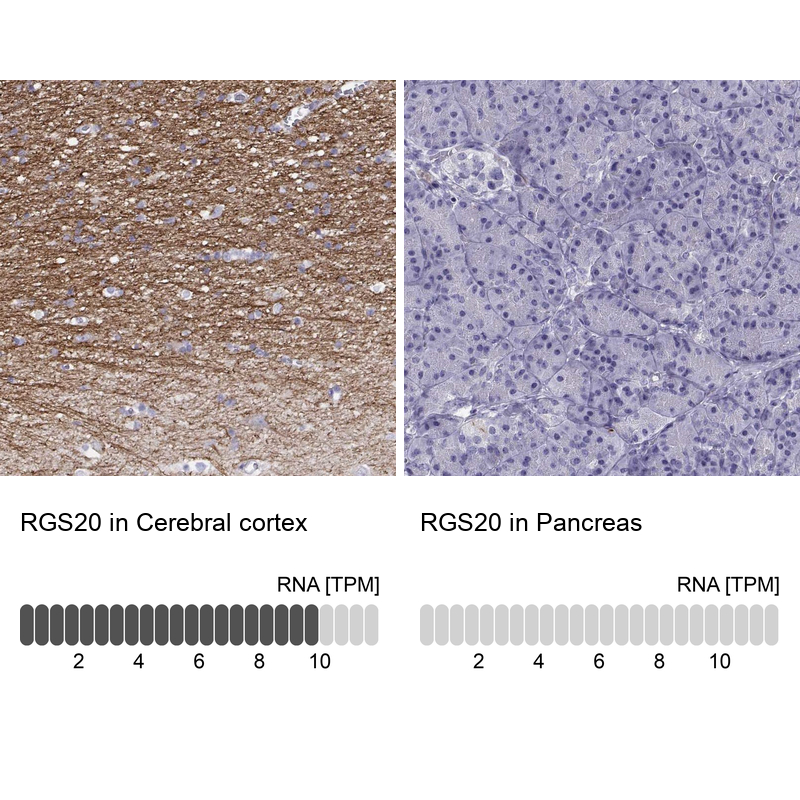 Anti-RGS20 Antibody
