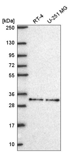 Anti-NR1H2 Antibody