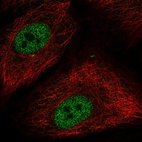 Immunofluorescent staining of human cell line A549 shows localization to nucleoplasm.