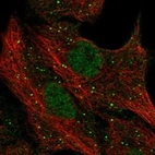 Anti-PGLYRP1 Antibody