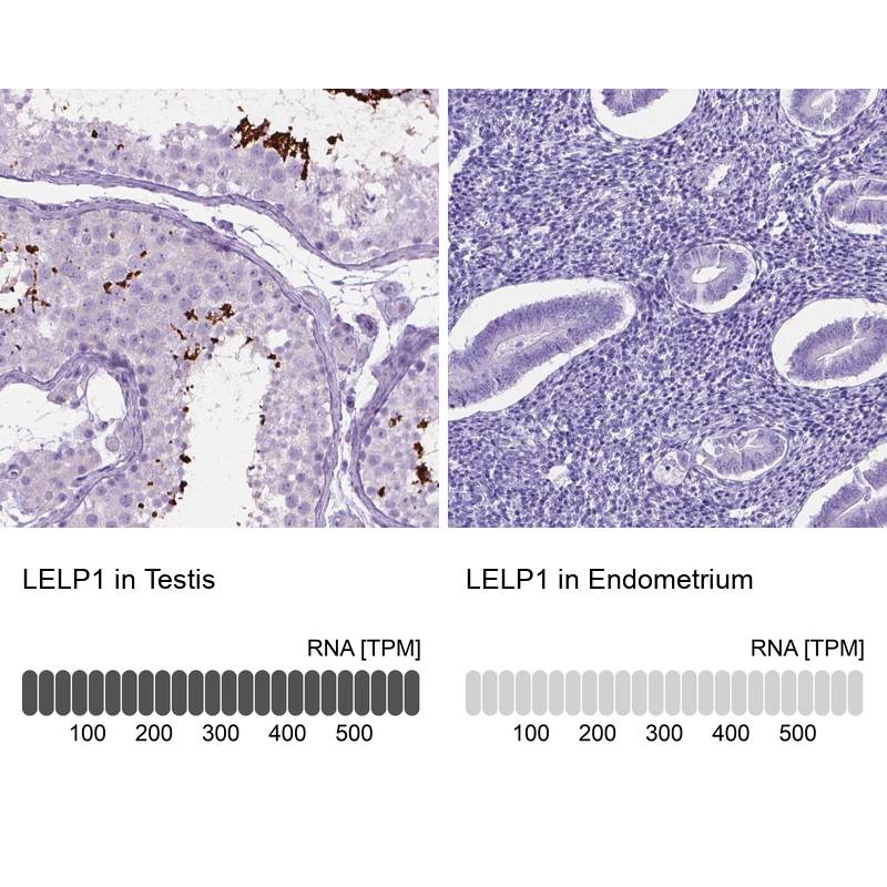 Anti-LELP1 Antibody