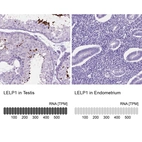 Anti-LELP1 Antibody
