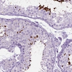 Immunohistochemical staining of human testis shows high expression.