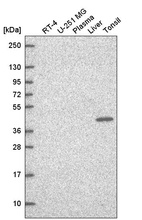 Anti-TFCP2 Antibody