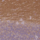 Immunohistochemical staining of human cerebellum shows moderate positivity in neuropil.
