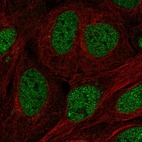 Immunofluorescent staining of human cell line U-2 OS shows localization to nucleoplasm.