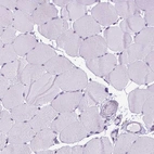 Immunohistochemical staining of human skeletal muscle shows no positivity in myocytes as expected.