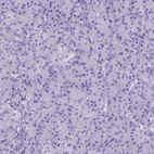 Immunohistochemical staining of human pancreas shows no positivity in exocrine glandular cells as expected.