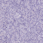 Anti-FAM124B Antibody