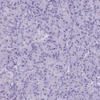 Immunohistochemical staining of human pancreas shows no positivity in exocrine glandular cells as expected.