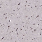 Anti-ARRB1 Antibody