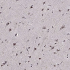 Anti-ARRB1 Antibody