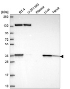 Anti-SC5D Antibody