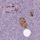 Immunohistochemical staining of human pancreas shows moderate to strong cytoplasmic positivity in islets of Langerhans.